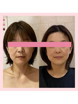 サロンドミジュ(Salon de 美jyu)/骨格・小顔矯正 &nbsp;40代