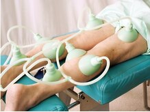 ナチュラルプラス整体クリニック/ウェーブカッピング