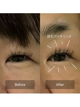 ミヨン(Miyong)/まぶたが重たくなってきた