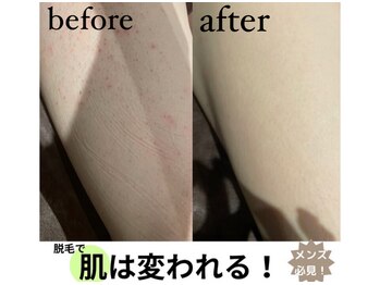 ワンエイト(One Eight)/【ビフォーアフター】脚