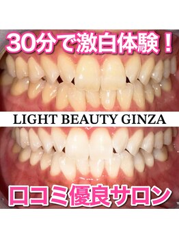 ライトビューティー 銀座店(LightBeauty)/東銀座 ホワイトニング症例写真
