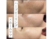 ラニウル(Laniulu)の雰囲気（赤羽にオープンした光が差し込むオープン型店舗。毛穴/シミ/美白）