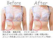 シエル(Siele)/デコルテの骨が気になる…