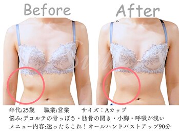 シエル(Siele)/デコルテの骨が気になる…