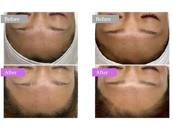 ホワイトワックス 福井店(WHITE WAX)/