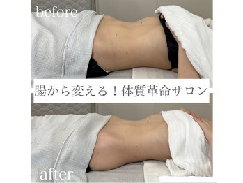 エスティーアンドユー(st&U)