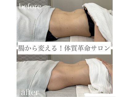 エスティーアンドユー(st&U)の写真