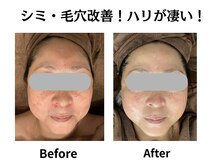 グレースティー 森町 箕面/通う度肌の透明度あがる！！