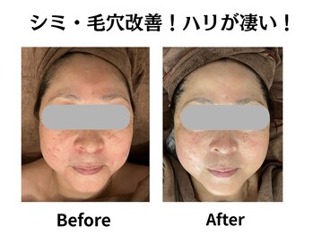 グレースティー 森町 箕面/通う度肌の透明度あがる！！