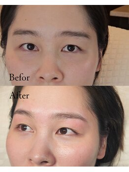 マテリアル(Material`)/before / after ～眉毛～