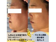 サロンド ララ(Salon de lala)