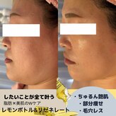 サロンド ララ(Salon de lala)