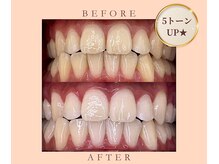 ルセホワイト 室蘭登別(LUCE WHITE)/