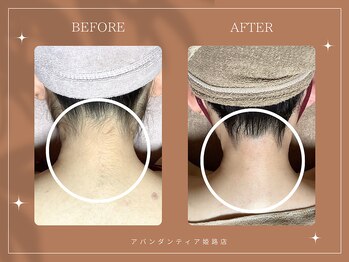 アバンダンティア 姫路店/後ろ姿まで美しく