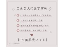 シェーン(Schon)/◆人気No.1◆IPL美肌フォト