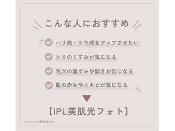 シェーン(Schon)/◆人気No.1◆IPL美肌フォト