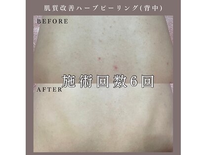 ベルミー(Bellmi)の写真