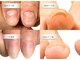 リケアネイル(Re:care nail)の写真/自爪育成/巻き爪ケアでお悩みを解消☆
