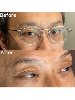 眉毛ハウス 吉祥寺店(眉毛HOUSE)/お客様の施術例(吉祥寺/東京)