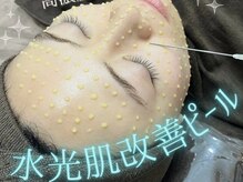 ミランオオサカ(MIRAN OSAKA)/続けるごとにお肌が変化