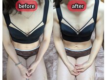 スノードロップ(snowdrop)/バストアップ　痩せ体型の方