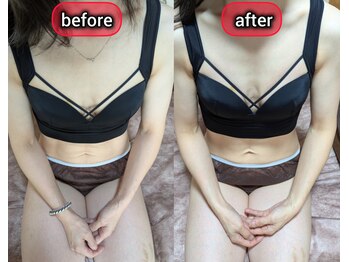 スノードロップ(snowdrop)/バストアップ　痩せ体型の方