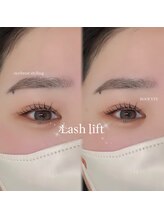 ルーフアイ(ROOF EYE)/ROOF EYE(ルーフ アイ)