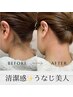 《うなじ》ダブル脱毛(光＋シュガーリング)　¥9,400→¥5,800