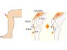 ★学割U24【ツライ成長痛（オスグッド）・シンスプリント】　¥4,000→¥2,000