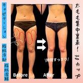 ティパニボーテ(Tipani Beaute')