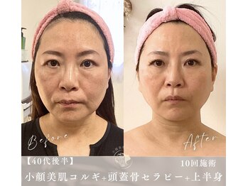 小顔美肌コルギ専門店 センティード 吉祥寺(Sentido)/