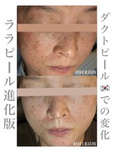 シュシュ(chouchou)/ダクトピール 3回目