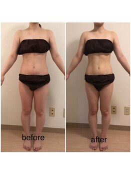 ココ(coco)/ダイエットモニター様