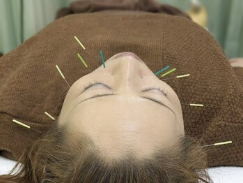 セキ鍼灸院の写真/【国家資格保持】今人気の美容鍼を当院で!血行促進/お肌のハリUP/シミ・しわ改善/むくみ改善などにお勧め♪