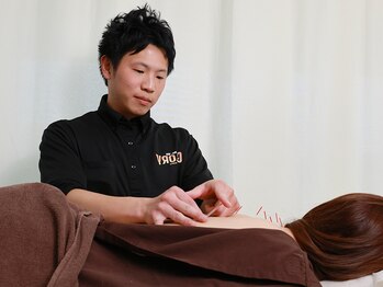 グローリー 甲府(GLORY)/長年の腰痛を改善【鍼施術】