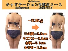 ビーバランス 本町店(美-Balance)/50代前半　月5部位コース
