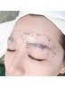 美眉毛＊*【アイブロウWAX脱毛 × ローズパック】1回