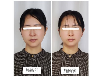 エクラ(eclat)の写真