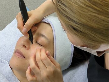 プラチナヒーリング(PLATINUM HEALING.)の写真/【ダウンタイムなし、即日メイクOK◎】乾燥は老け見えの原因！シミやシワにアプローチし若々しい見た目に★