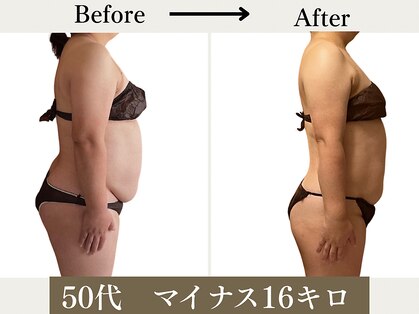 リウル(RiUll)の写真