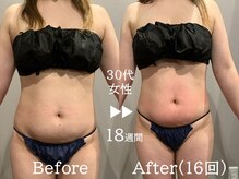 ルナステラ 七尾店/サーモシェイプDEEP