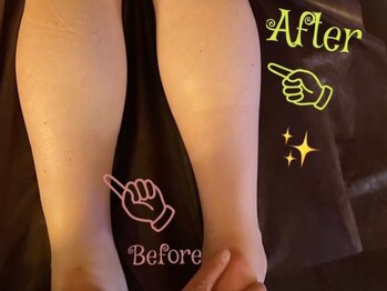 温和活 ロータス(温和活Lotus蓮:)/オイルリンパマッサージ施術変化