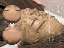ティアラッシュ(TiaLash)の雰囲気（大人気ハーブピーリングで肌荒れ改善・艶肌・透明感のある肌へ★）