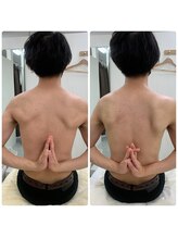 ソルニス(Solnis.)/痩身☆脂肪分解/ハイパーナイフ