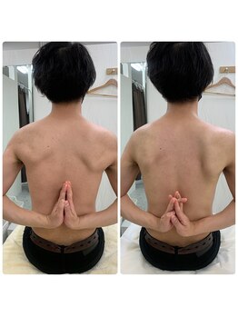 ソルニス(Solnis.)/痩身☆脂肪分解/ハイパーナイフ