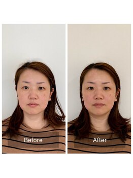 ハリラボ(hari Lab.)/【お客様の声】