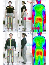 姫路なごみ整体院 なごみ鍼灸院/改善例）（腰痛・肩こり・反腰）