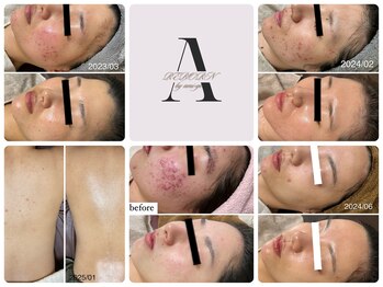 リボーン バイ アミーゴ(REBORN by ami-go)