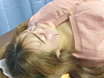 オハナ鍼灸接骨院(Ohana鍼灸接骨院)の写真/【美容鍼で輝く素肌へ♪】スッキリとしたフェイスラインに導きます！しわたるみケアなどのお悩みにも◎