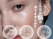 エルブラン(Aile-blanc)